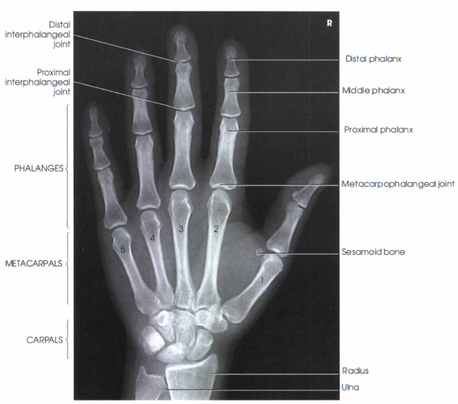 HAND X - RAY | PA HAND - RadTechOnDuty