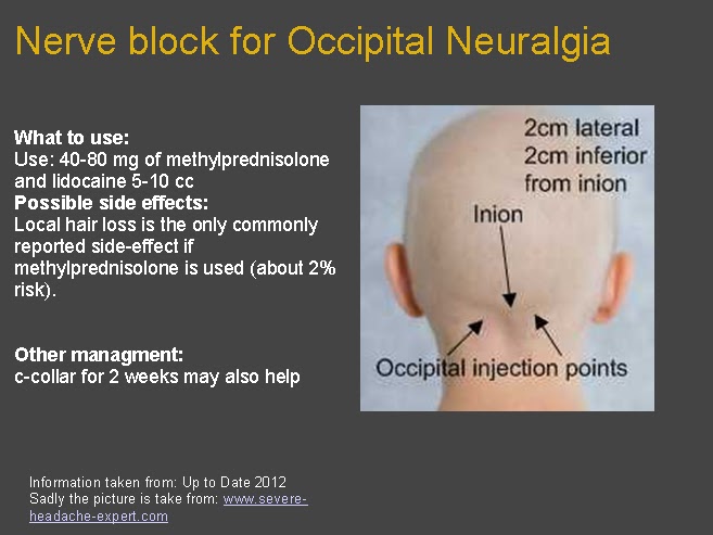 Occipital Nerve Block Injection