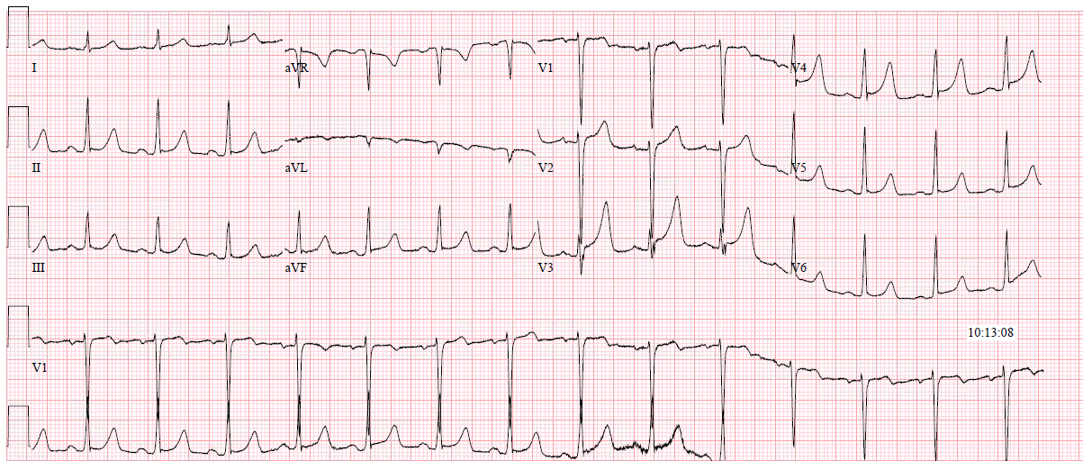 Dr. Smith's ECG Blog: 