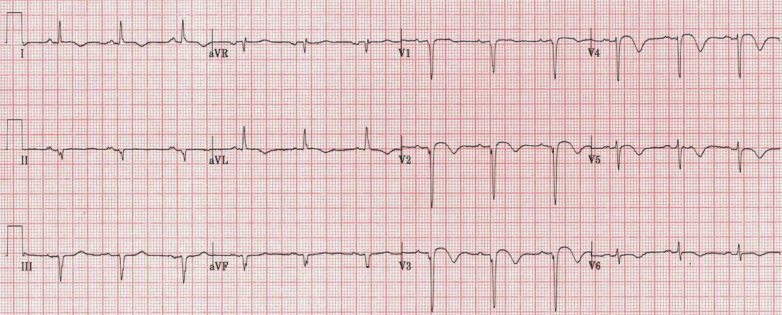 Dr. Smith's ECG Blog: October 2015