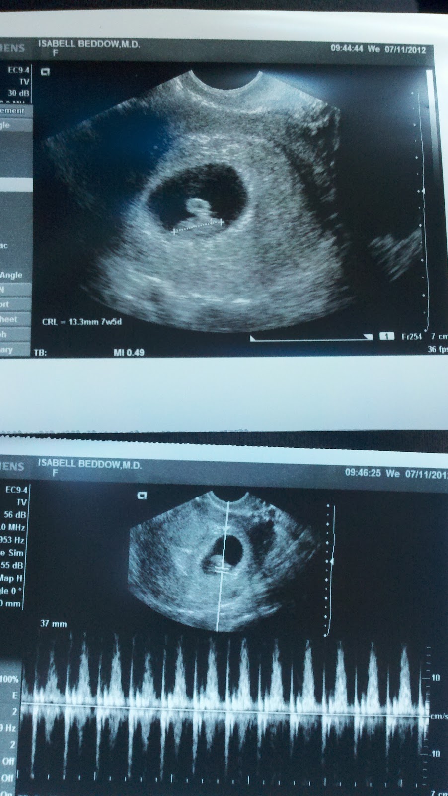 Little Ol' Me: Update on fundal height.