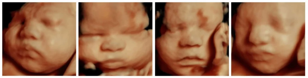 5D ultrasound package for pregnant women to see their baby. 3D 4D ultrasounds