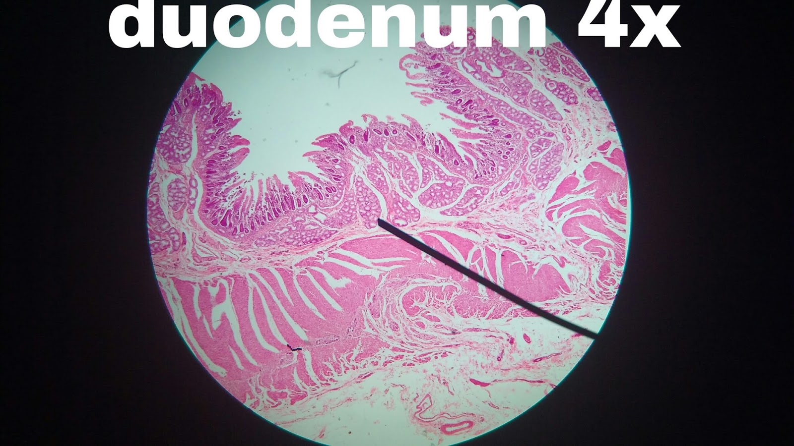 Histology Duodenum Duodenum 4x Histology Ap Ii Pinterest Images