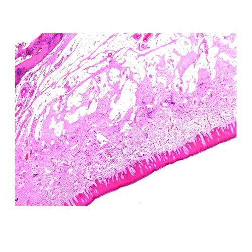 Hard Palate Histology