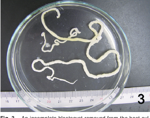 Figure 3 from Larval Cestodes Found in the Skeletal Muscle of Cultured ...