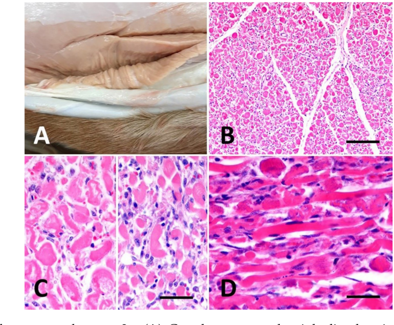 Figure 1 from Rhabdomyolysis and Acute Renal Failure Associated with ...