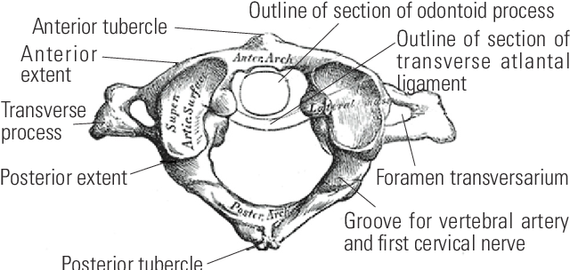 Figure 1 from Computed Tomography Scan-Based Morphometric Analysis of ...