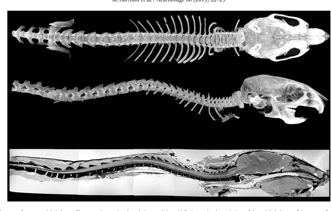 Figure 4 from Vertebral landmarks for the identification of spinal cord ...