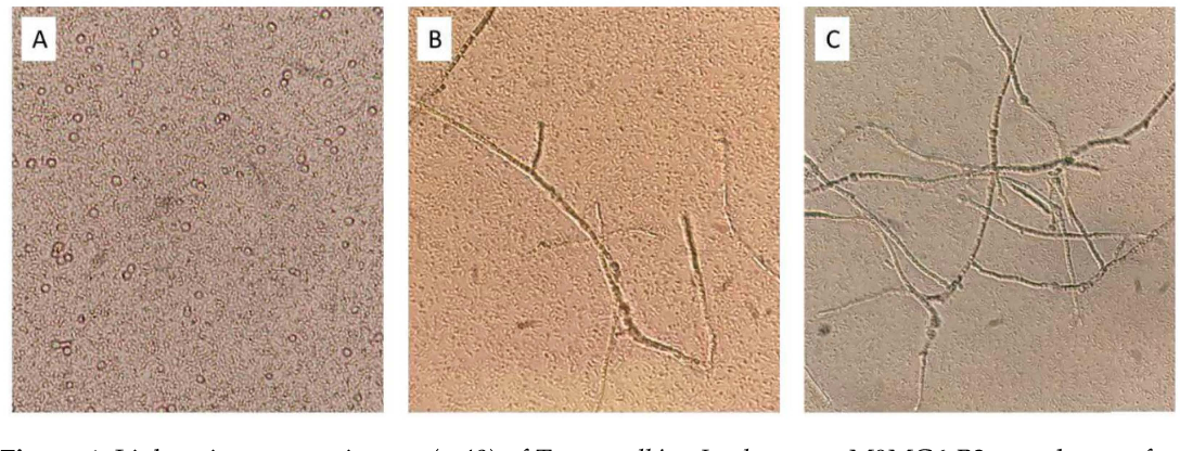 Figure 1 from Fungal–Lactobacteria Consortia and Enzymatic Catalysis ...