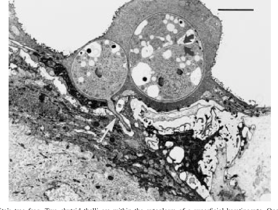 Figure 4 from Cutaneous Chytridiomycosis in Poison Dart Frogs ...