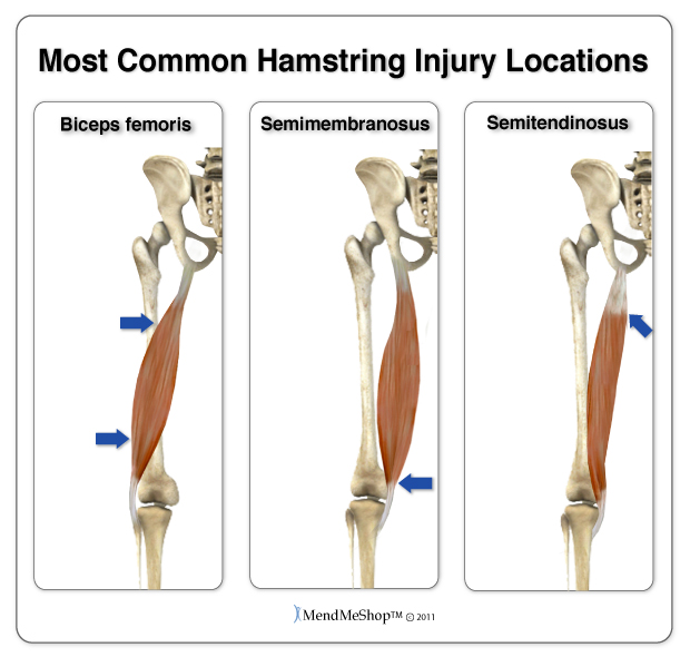 where hamstring injuries usually happen