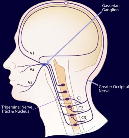 Headache & Migraine - Ainsworth Institute