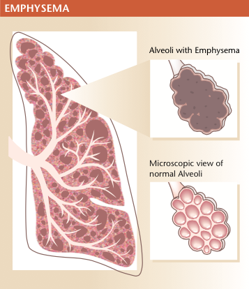 Pulmonary Medicine