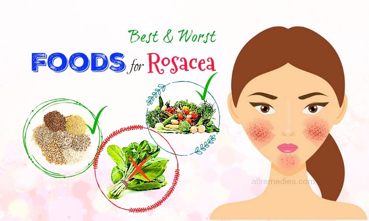 foods for rosacea