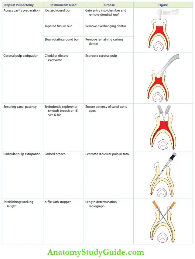 Pulpectomy In Primary Teeth Notes - Anatomy Study Guide