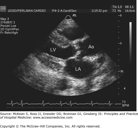 Valvular Heart Disease | Anesthesia Key