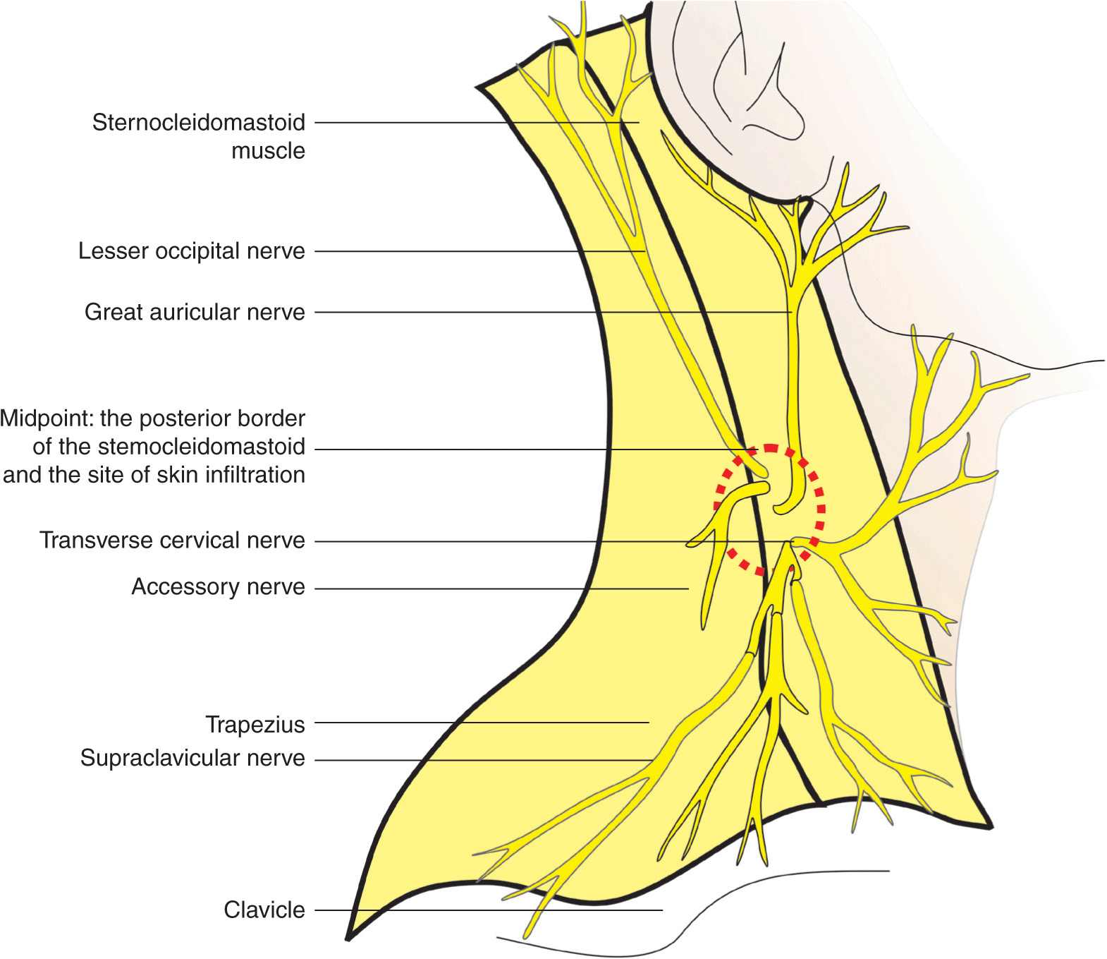 Lumbar Plexus Nerve Block