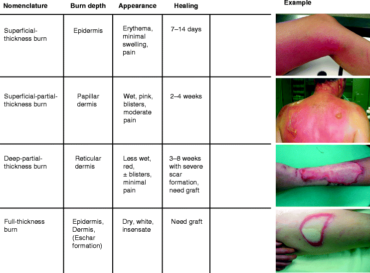 Burn Assessment Chart