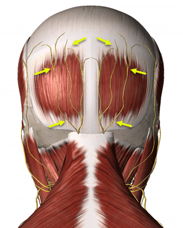 Occipital Neuralgia