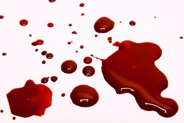 Illustration - Shutterstock | <a href="https://www.shutterstock.com/image-photo/blood-stains-on-white-background-126885983">Oksana Mizina</a>