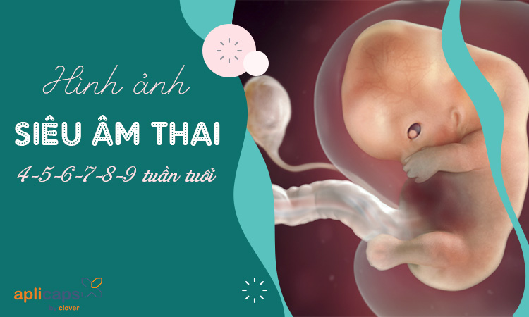 Hình ảnh Phim Hoạt Hình Chó Siêu Nhân PNG Miễn Phí Tải Về  Lovepik