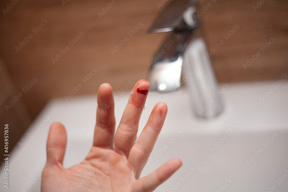 The man cut his finger. A cut. Blood flows from the finger