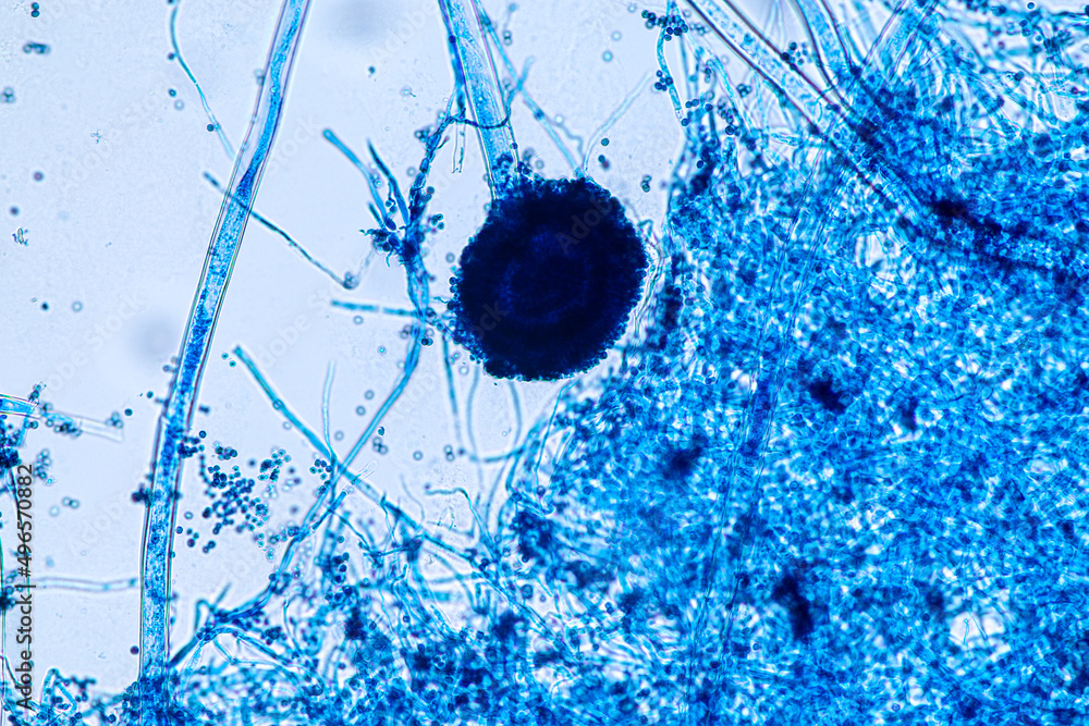 Aspergillus niger and Aspergillus oryzae (mold) under microscope for ...