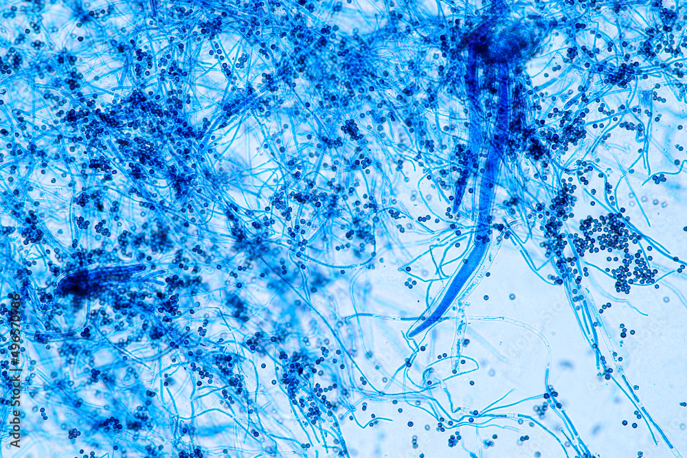 Aspergillus niger and Aspergillus oryzae (mold) under microscope for ...