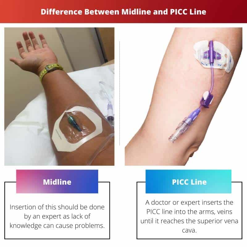 Midline vs PICC Line: Difference and Comparison