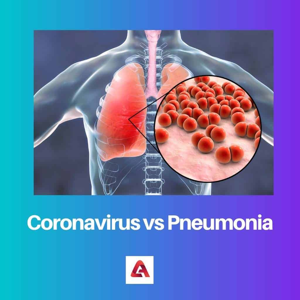 Coronavirus vs Pneumonia: Difference and Comparison