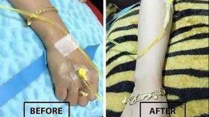 Rutin-Infus-Whitening-Wanita-Muda-Ini-Jadi-Pasien-Autoimune.jpg