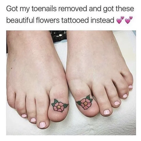 This photo shows the missing toe nails before the tattoo  Download  Scientific Diagram