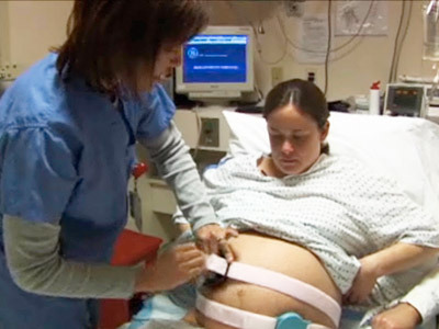 Play video: Birth of twins: video