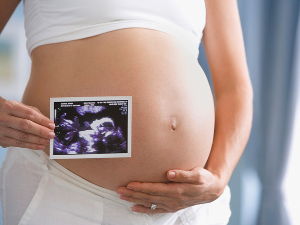 Pregnant woman holding ultrasound picture next to her bump