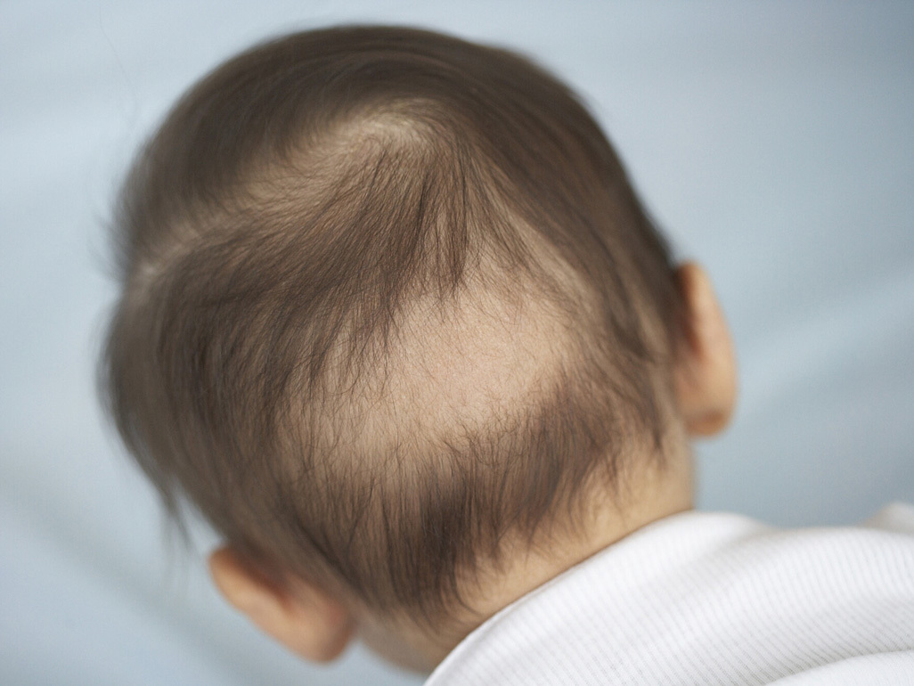 back of a baby's head with a bold spot