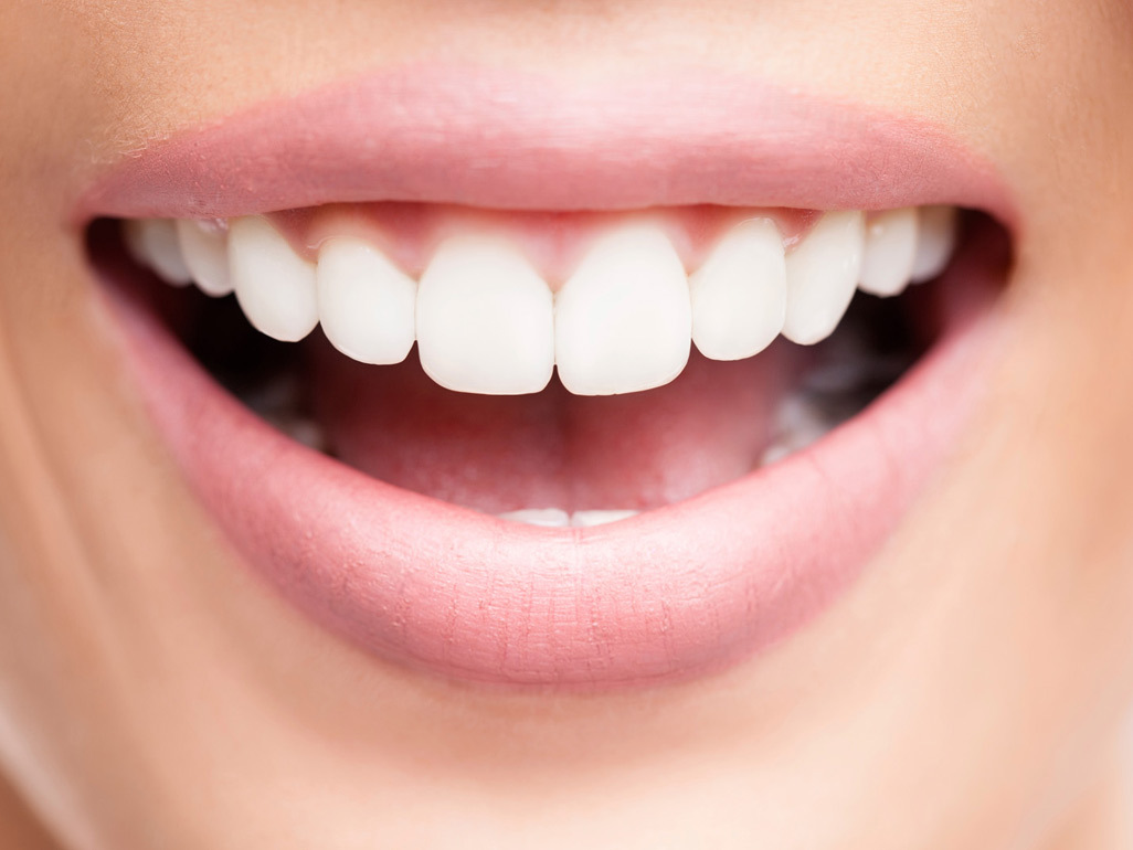 woman's smiling mouth showing teeth