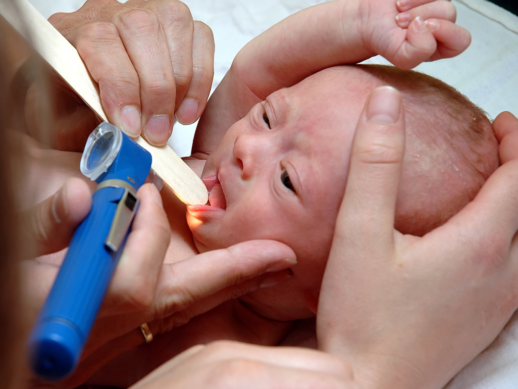 doctors examining baby's throat