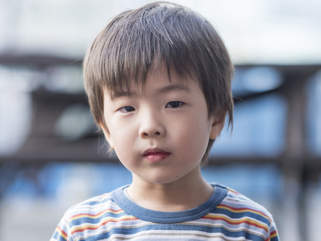 boy with small dark bump on lip