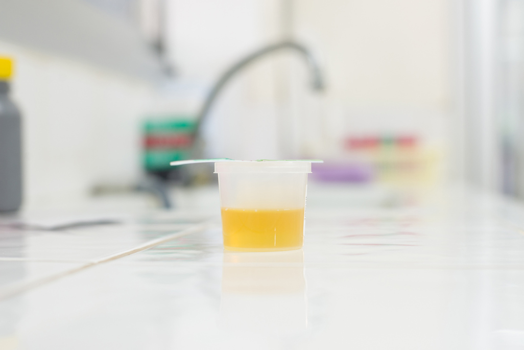 Urine sample