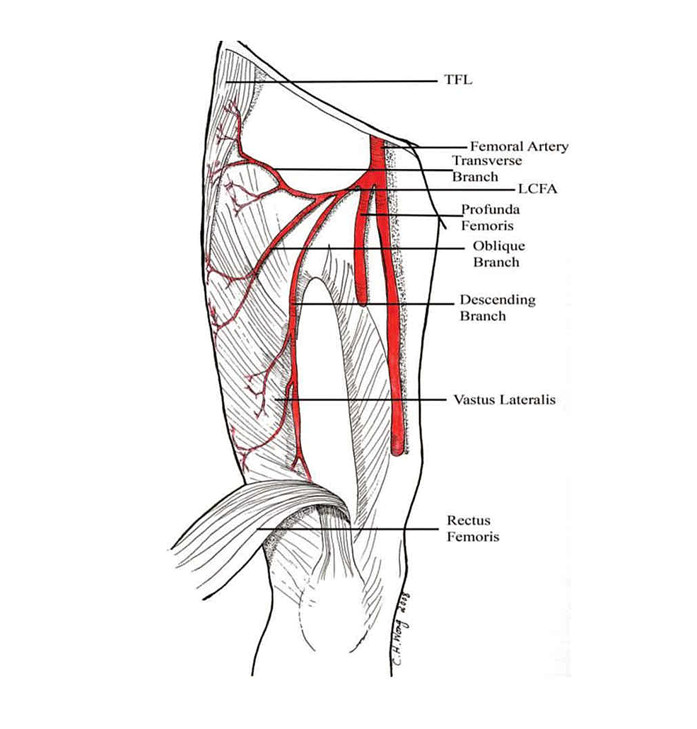 Femoral Artery Diagram