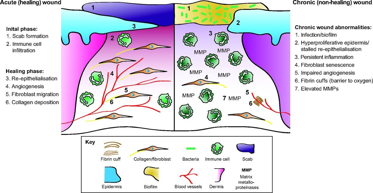 [DIAGRAM] Body Diagram Wound Healing - MYDIAGRAM.ONLINE