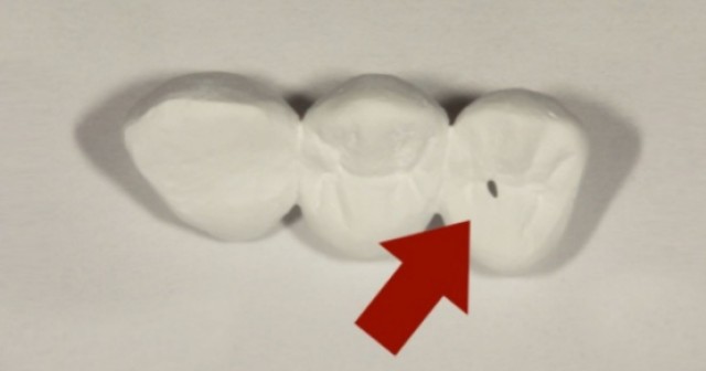 The Impact of Handwork and Coloring Agents on Monolithic Zirconia