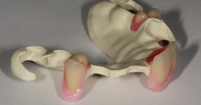 Is Flexural Strength a Keystone Property of Restorative Dental Materials?