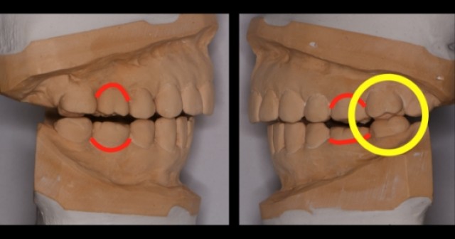 The Role the First Point of Contact Plays in the Restorative Process