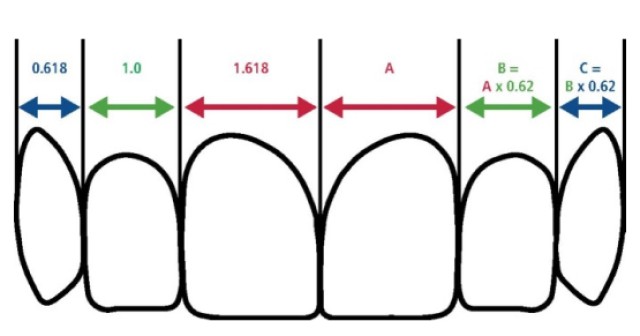 Managing the Midline Diastema Part 2: Challenges