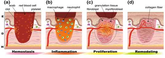 Wound Healing Diagram