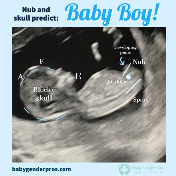 12 week ultrasound gender