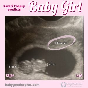 Ramzi Theory Girl Example Image 5