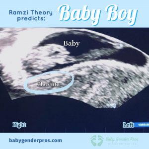 Ramzi Theory Boy Example - Image 1