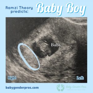 Ramzi Theory Boy Example Image 2